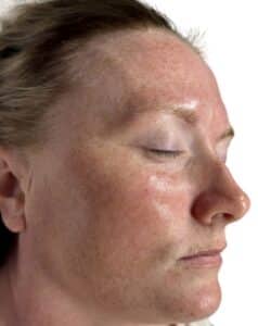 Before Image: BioRePeel
