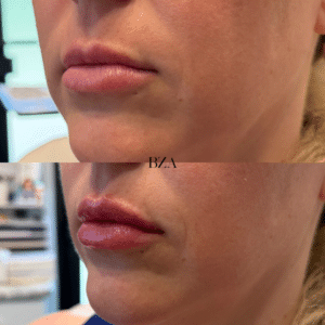 Before and Afters 3