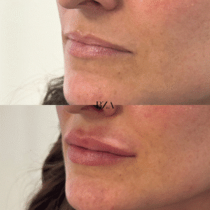 Before and Afters (1080 x 1350 px) 302