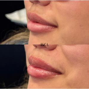 Before and Afters (1080 x 1350 px) 312