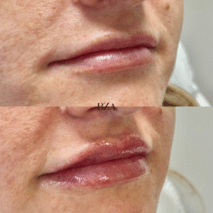 Before and Afters (1080 x 1350 px) 336