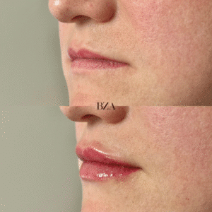 Before and Afters (1080 x 1350 px) 343