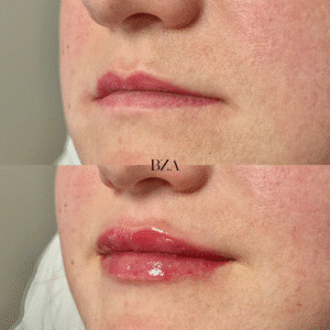 Before and Afters (1080 x 1350 px) 344