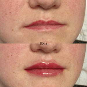 Before and Afters (1080 x 1350 px) 345