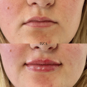 Before and Afters (1080 x 1350 px) 360