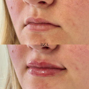 Before and Afters (1080 x 1350 px) 361