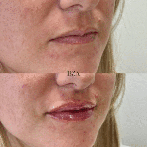 Before and Afters (1080 x 1350 px) 370
