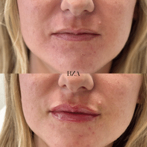 Before and Afters (1080 x 1350 px) 373