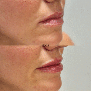 Before and Afters (1080 x 1350 px) 383