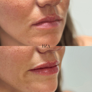 Before and Afters (1080 x 1350 px) 386