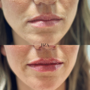 Before and Afters (1080 x 1350 px) 389