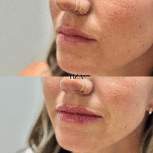 Before and Afters (1080 x 1350 px) 391