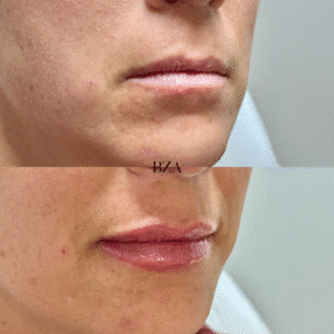 Before and Afters (1080 x 1350 px) 413