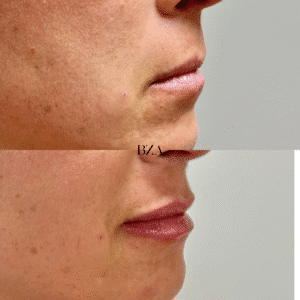 Before and Afters (1080 x 1350 px) 415